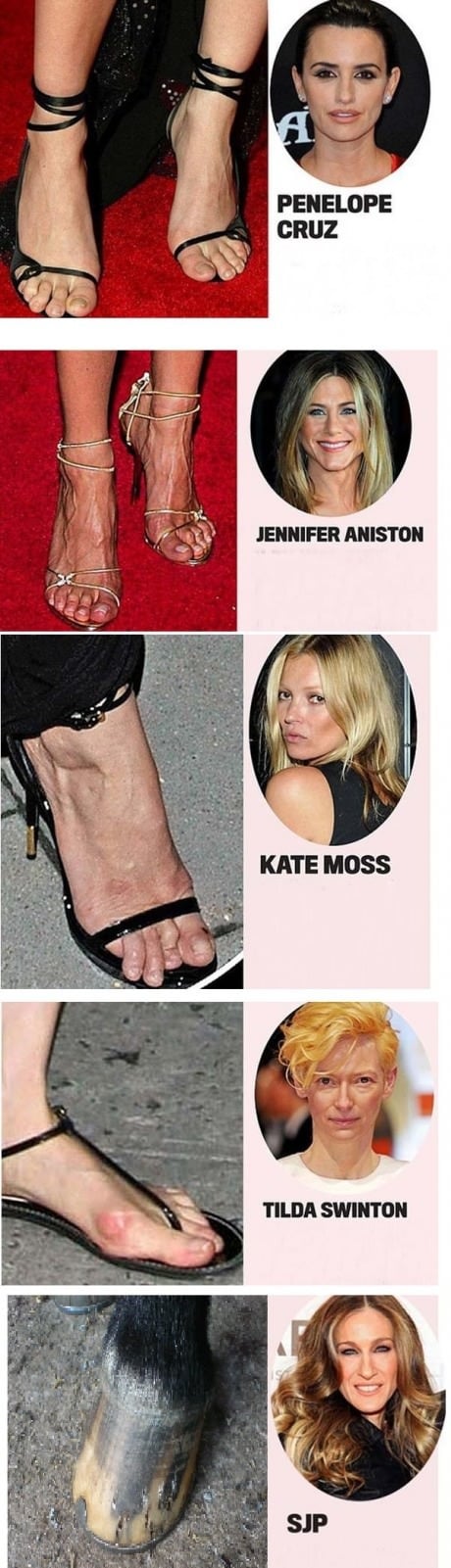 The Ugliest Celebrity Feet
