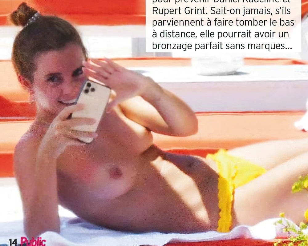 Emma Watson Topless Nude Sunbathing Photos Published In France