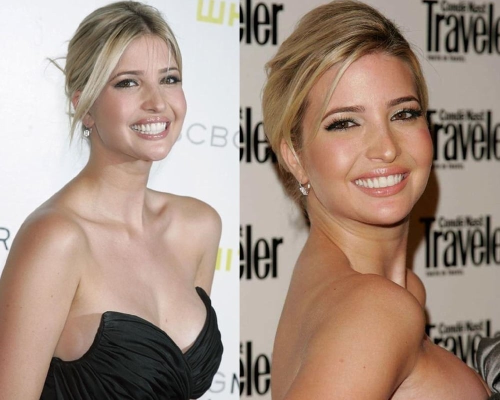 Ivanka Trump tits