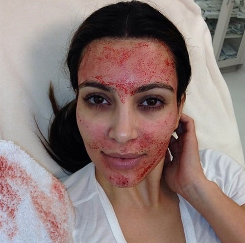 Kim Kardashian’s Face Covered In Blood
