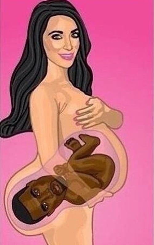 Kim Kardashian ultrasound