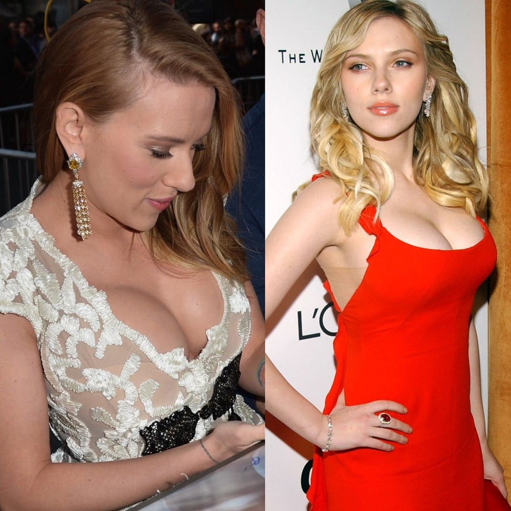 Scarlett Johansson’s Tits Have Given Up
