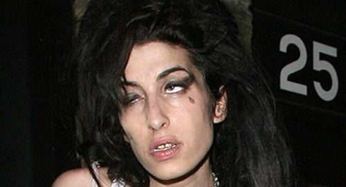 HIV Cured of Amy Winehouse
