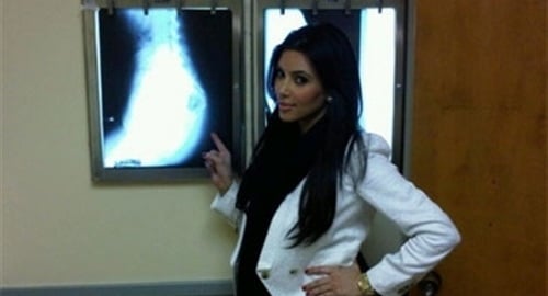 Kim Kardashian Diagnosed With Terminal Ass Cancer