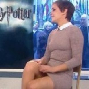 Emma Watson Flashes Upskirt On The Today Show