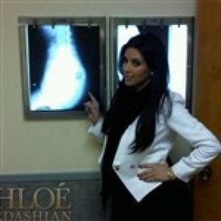 Kim Kardashian Diagnosed With Terminal Ass Cancer