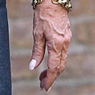 Kirstie Alley’s Disgusting Wrinkled Hands