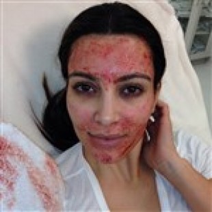 Kim Kardashian’s Face Covered In Blood